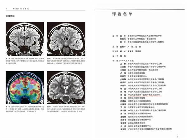 中山一院广西医院放射影像科牵头完成首部主译著作——《癫痫影像病理图解》